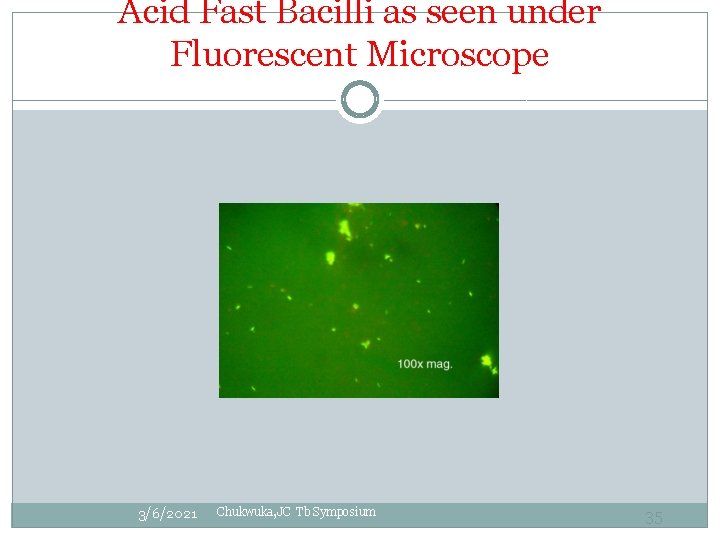 Acid Fast Bacilli as seen under Fluorescent Microscope 3/6/2021 Chukwuka, JC Tb Symposium 35