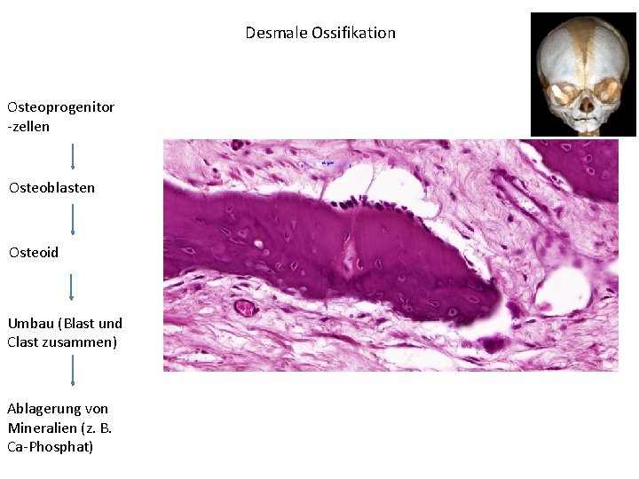 Desmale Ossifikation Osteoprogenitor -zellen Osteoblasten Osteoid Umbau (Blast und Clast zusammen) Ablagerung von Mineralien