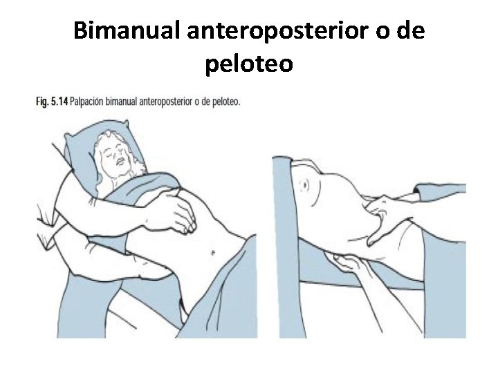 Bimanual anteroposterior o de peloteo 