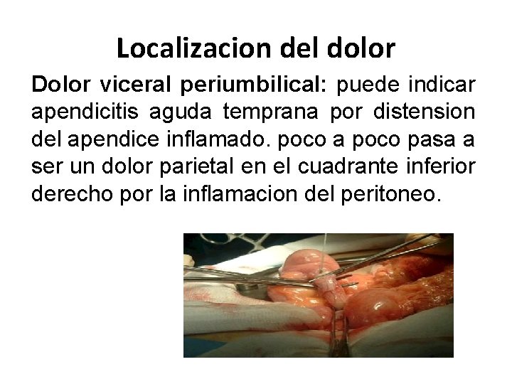 Localizacion del dolor Dolor viceral periumbilical: puede indicar apendicitis aguda temprana por distension del