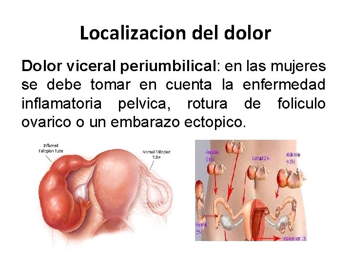 Localizacion del dolor Dolor viceral periumbilical: en las mujeres se debe tomar en cuenta