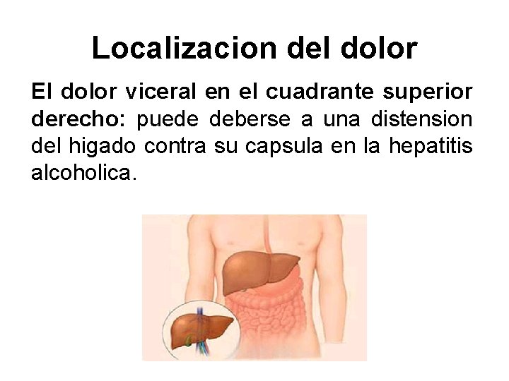 Localizacion del dolor El dolor viceral en el cuadrante superior derecho: puede deberse a