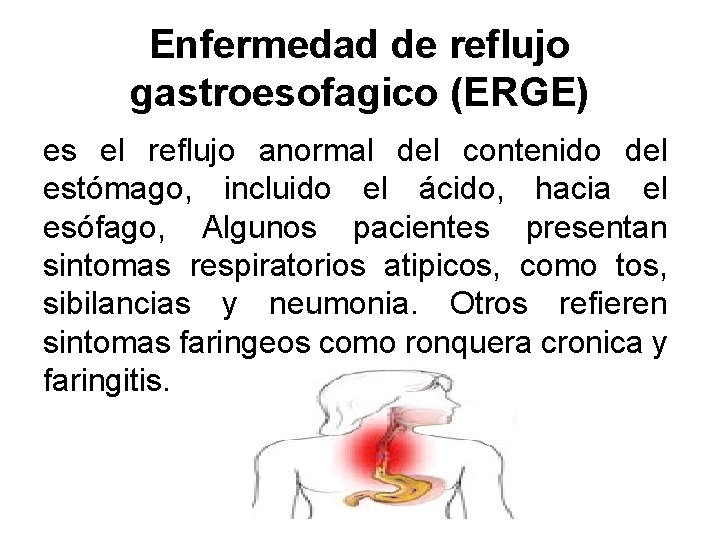 Enfermedad de reflujo gastroesofagico (ERGE) es el reflujo anormal del contenido del estómago, incluido