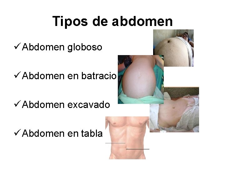 Tipos de abdomen ü Abdomen globoso ü Abdomen en batracio ü Abdomen excavado ü Tipos de abdomen ü Abdomen globoso ü Abdomen en batracio ü Abdomen excavado ü