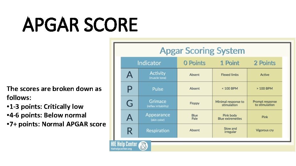 APGAR SCORE The scores are broken down as follows: • 1 -3 points: Critically