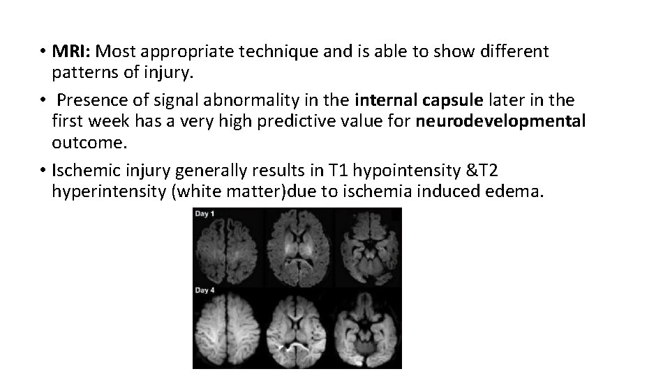  • MRI: Most appropriate technique and is able to show different patterns of