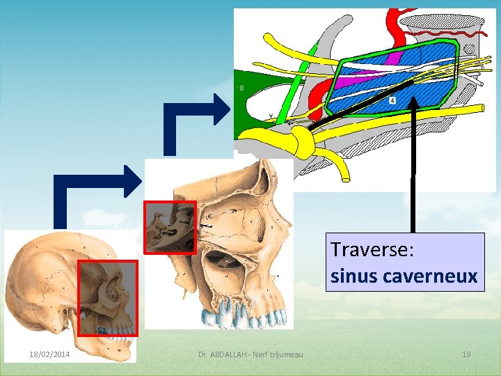 Traverse: sinus caverneux 18/02/2014 Dr. ABDALLAH - Nerf trijumeau 19 Traverse: sinus caverneux 18/02/2014 Dr. ABDALLAH - Nerf trijumeau 19