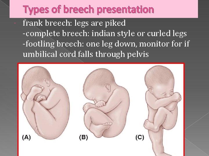 Types of breech presentation frank breech: legs are piked -complete breech: indian style or