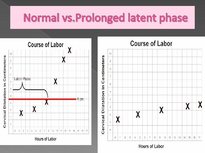 Normal vs. Prolonged latent phase 