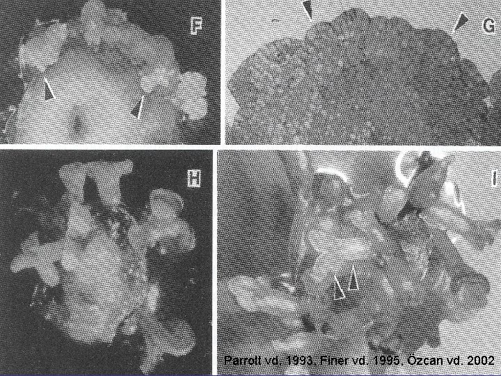 Parrott vd. 1993, Finer vd. 1995, Özcan vd. 2002 