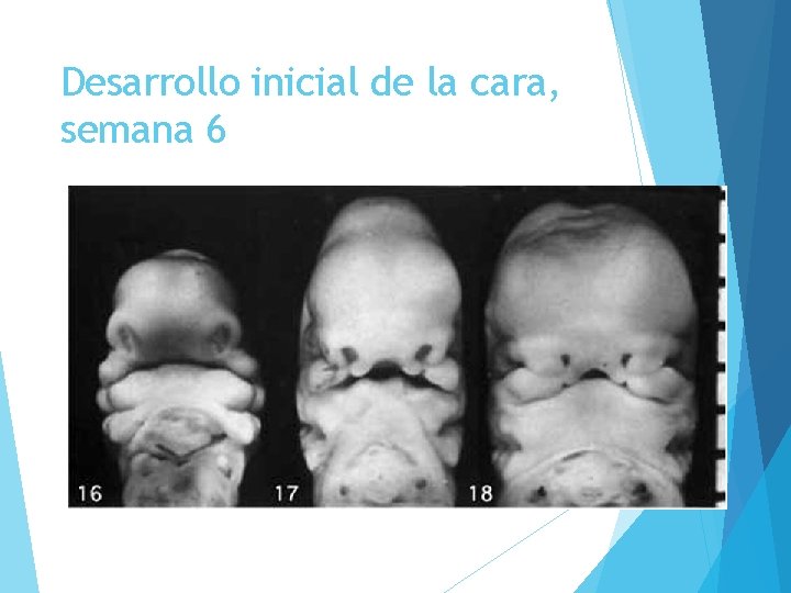 Desarrollo inicial de la cara, semana 6 