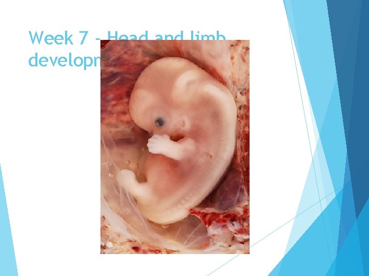 Week 7 - Head and limb development 