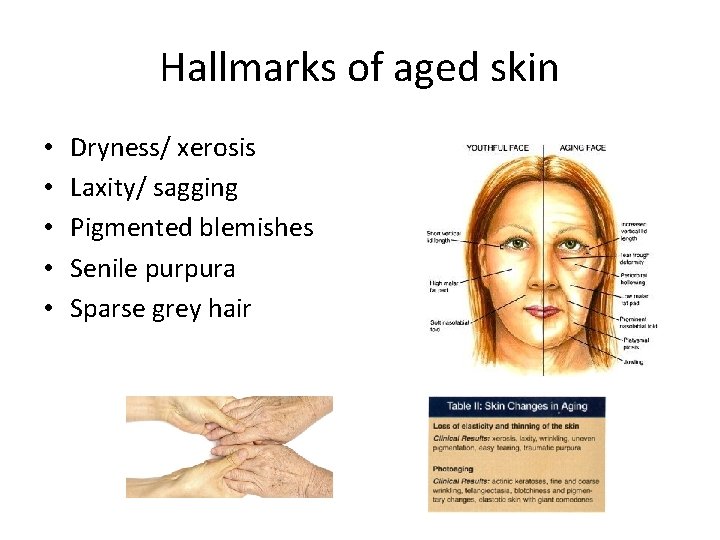 Hallmarks of aged skin • • • Dryness/ xerosis Laxity/ sagging Pigmented blemishes Senile