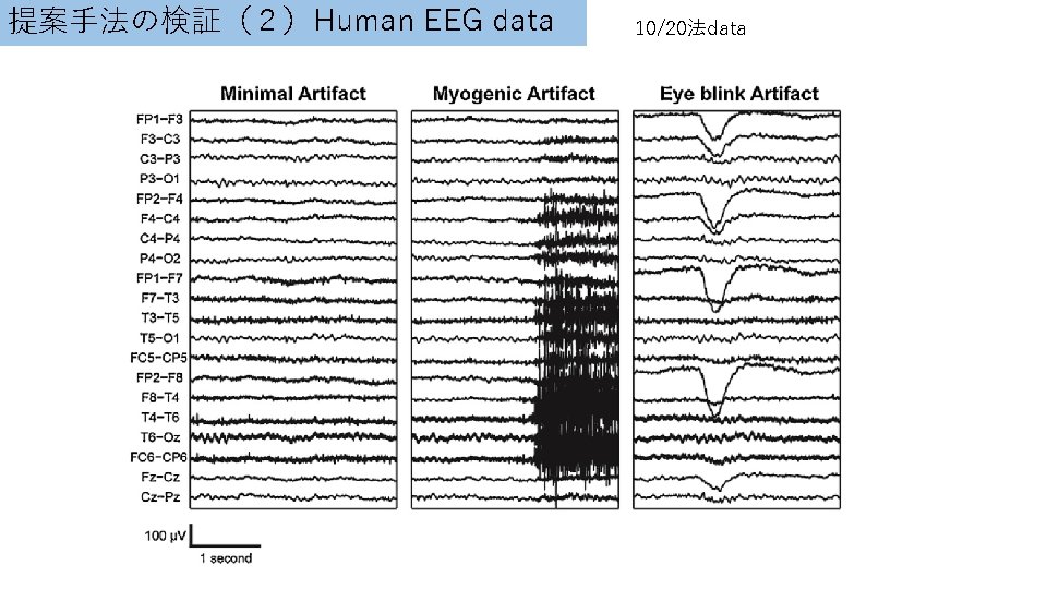 提案手法の検証（２）Human EEG data 10/20法data 