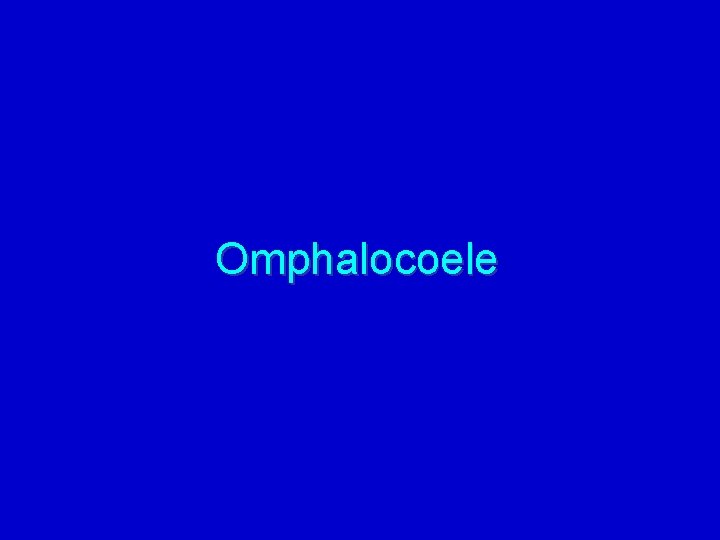 Omphalocoele 