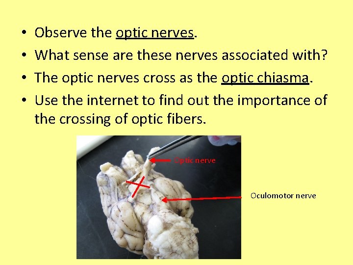 • • Observe the optic nerves. What sense are these nerves associated with?