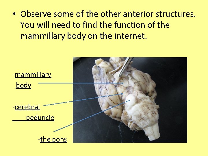  • Observe some of the other anterior structures. You will need to find
