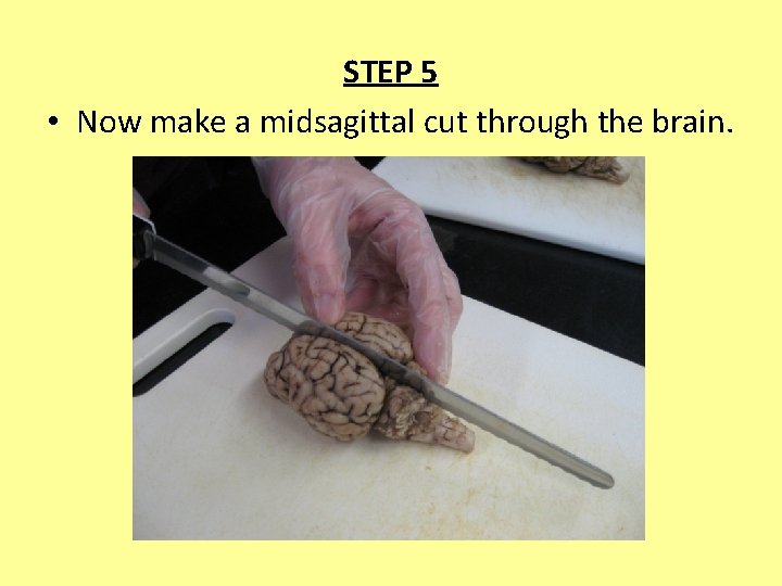 STEP 5 • Now make a midsagittal cut through the brain. 