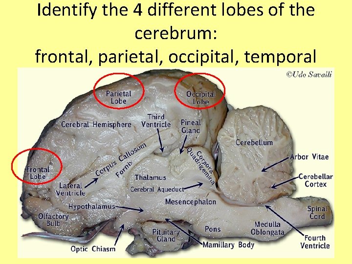 Identify the 4 different lobes of the cerebrum: frontal, parietal, occipital, temporal 