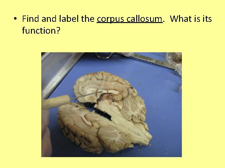  • Find and label the corpus callosum. What is its function? 