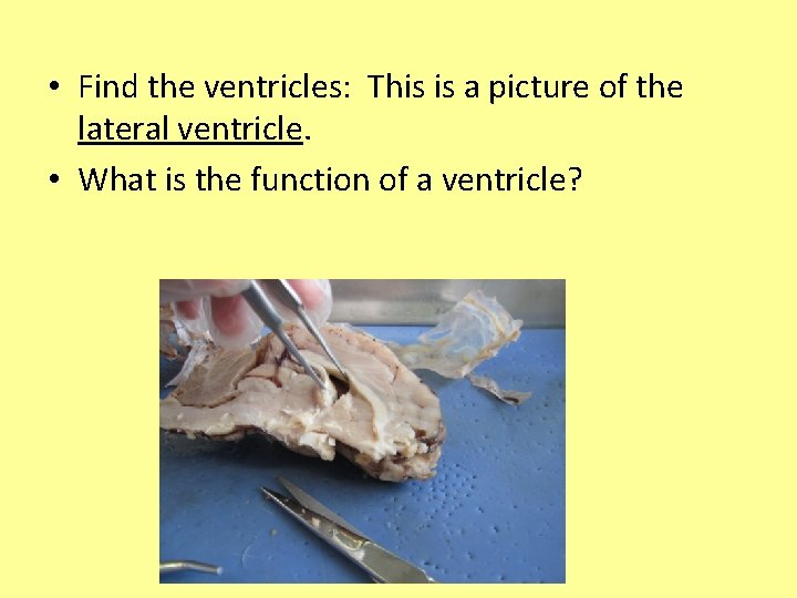  • Find the ventricles: This is a picture of the lateral ventricle. •