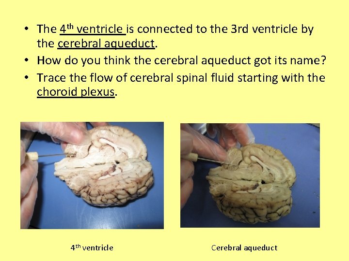  • The 4 th ventricle is connected to the 3 rd ventricle by