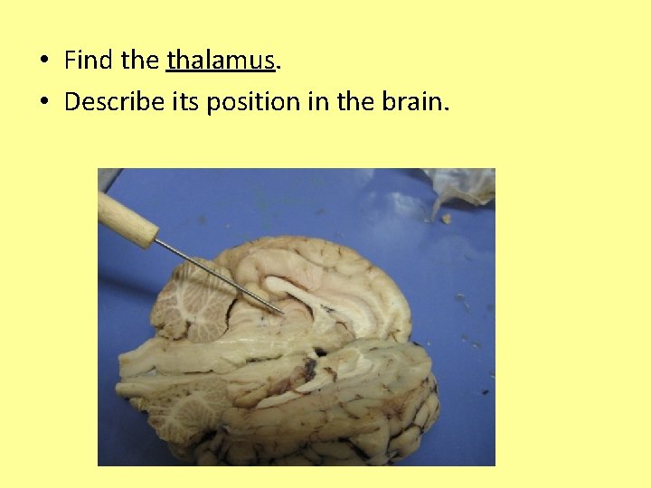  • Find the thalamus. • Describe its position in the brain. 