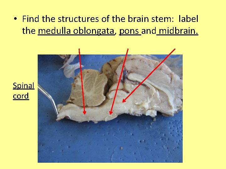  • Find the structures of the brain stem: label the medulla oblongata, pons