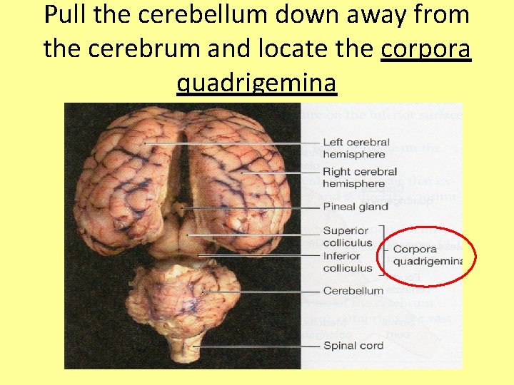 Pull the cerebellum down away from the cerebrum and locate the corpora quadrigemina 