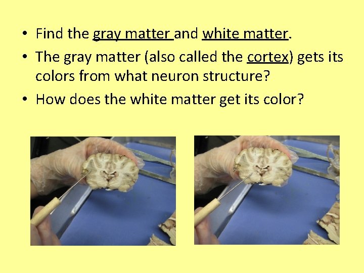  • Find the gray matter and white matter. • The gray matter (also