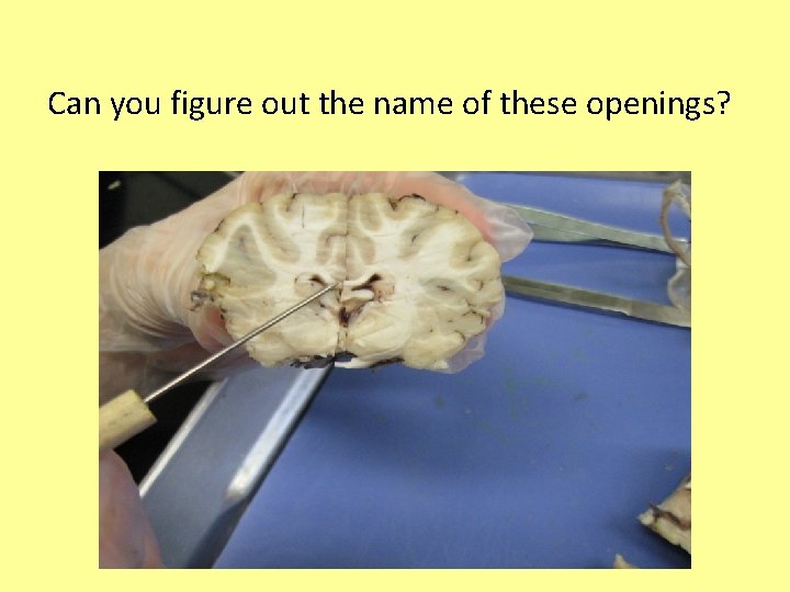 Can you figure out the name of these openings? 