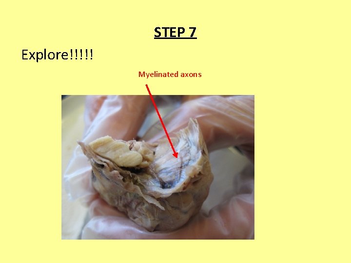 STEP 7 Explore!!!!! Myelinated axons 