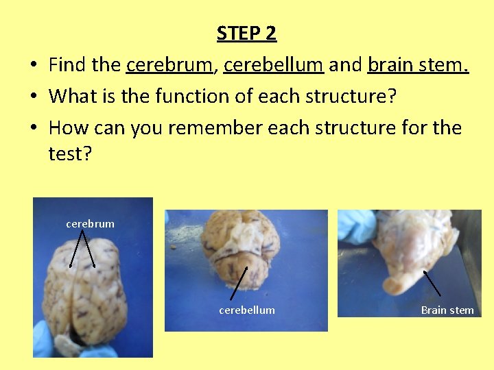 STEP 2 • Find the cerebrum, cerebellum and brain stem. • What is the