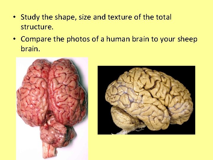  • Study the shape, size and texture of the total structure. • Compare