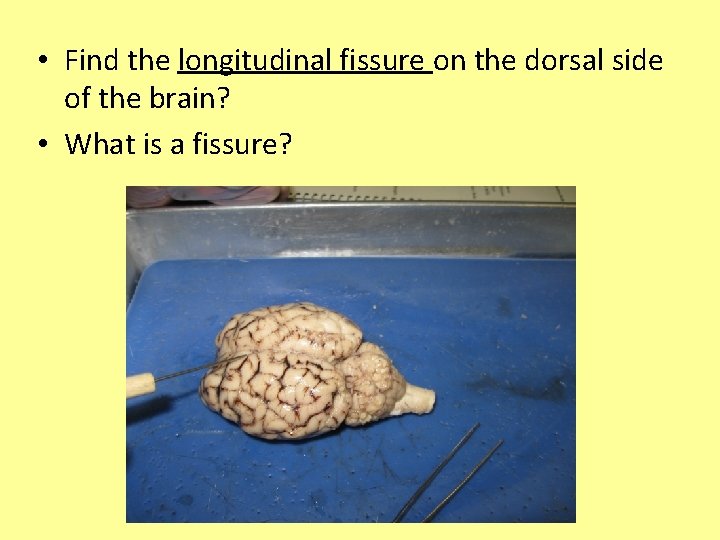  • Find the longitudinal fissure on the dorsal side of the brain? •