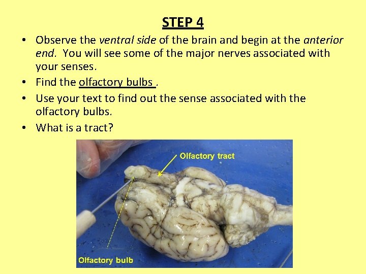 STEP 4 • Observe the ventral side of the brain and begin at the
