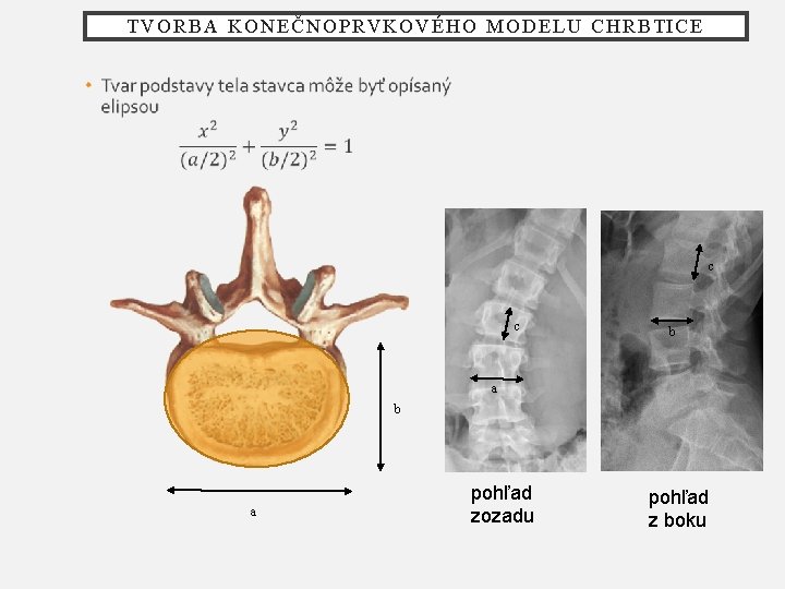 TVORBA KONEČNOPRVKOVÉHO MODELU CHRBTICE c c b a pohľad zozadu pohľad z boku 