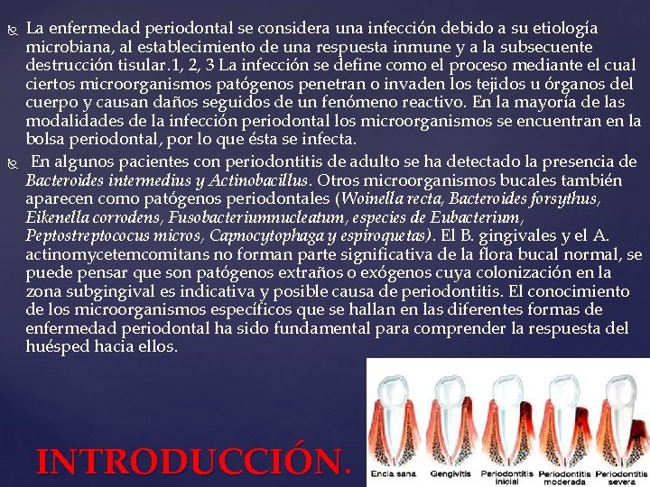  La enfermedad periodontal se considera una infección debido a su etiología microbiana, al