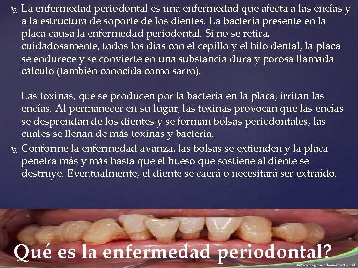  La enfermedad periodontal es una enfermedad que afecta a las encías y a