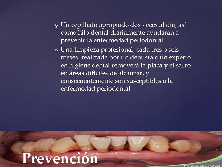  Un cepillado apropiado dos veces al día, así como hilo dental diariamente ayudarán