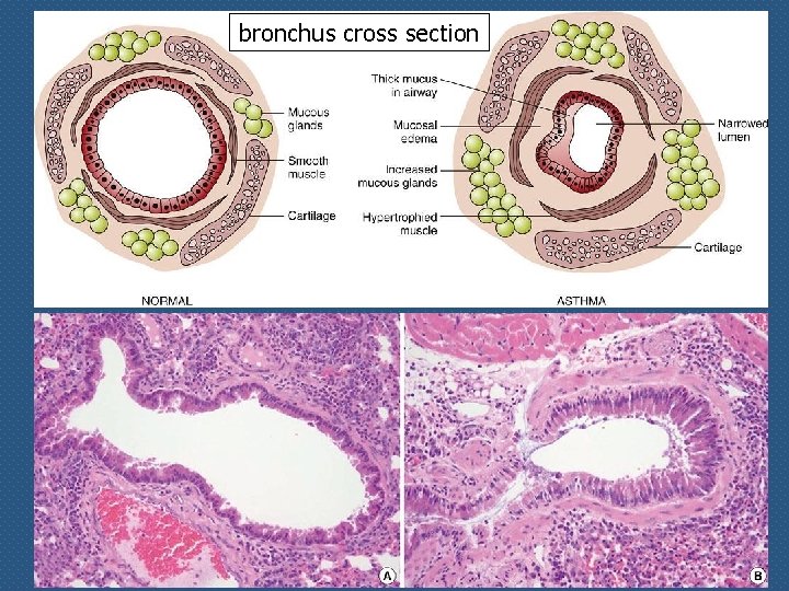 bronchus cross section 