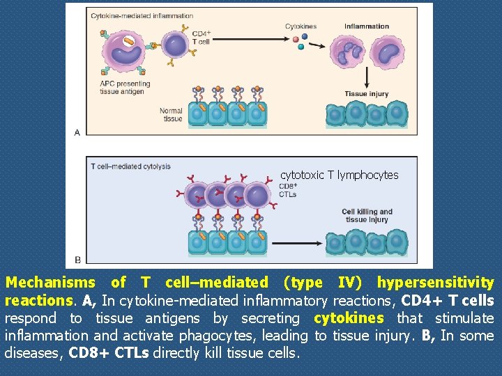 cytotoxic T lymphocytes Mechanisms of T cell–mediated (type IV) hypersensitivity reactions. A, In cytokine-mediated