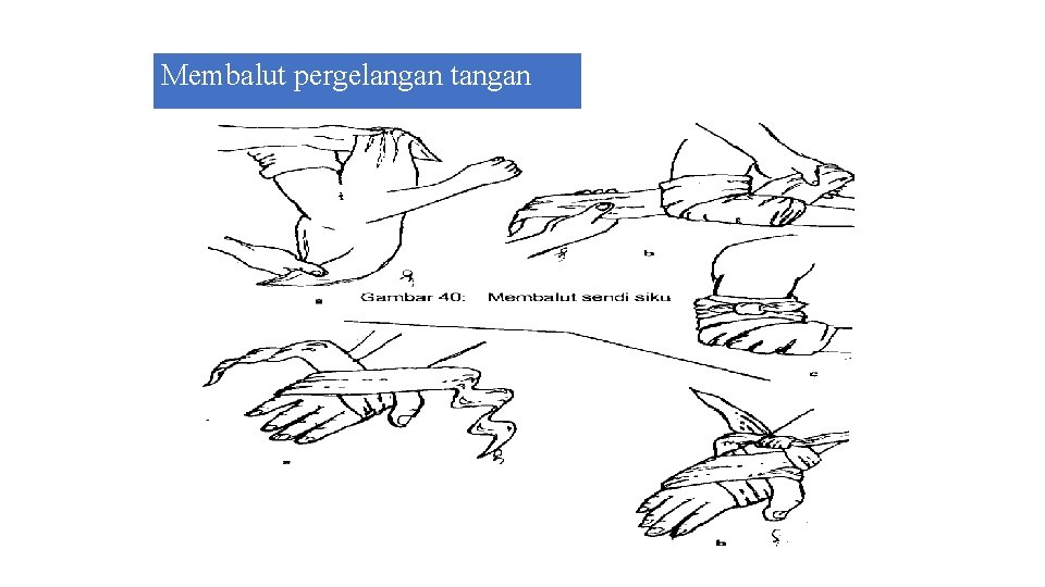 Membalut pergelangan tangan 