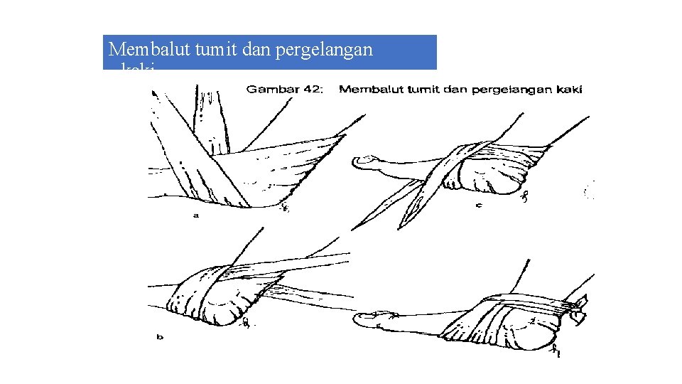 Membalut tumit dan pergelangan kaki 