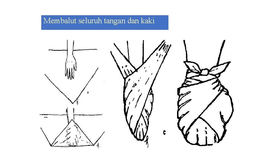 Membalut seluruh tangan dan kaki 