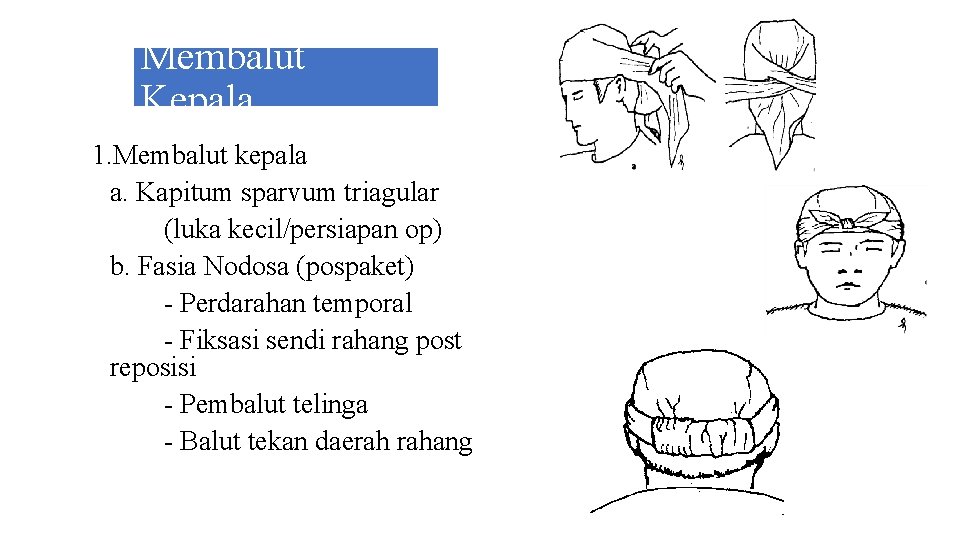 Membalut Kepala 1. Membalut kepala a. Kapitum sparvum triagular (luka kecil/persiapan op) b. Fasia