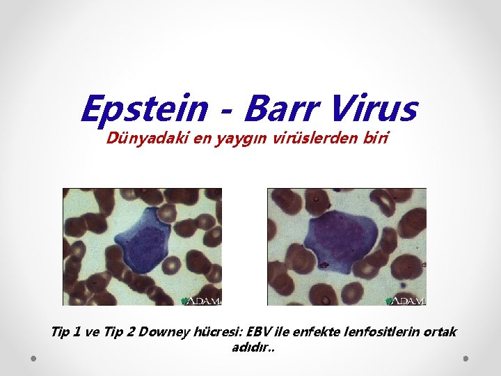 Epstein - Barr Virus Dünyadaki en yaygın virüslerden biri Tip 1 ve Tip 2