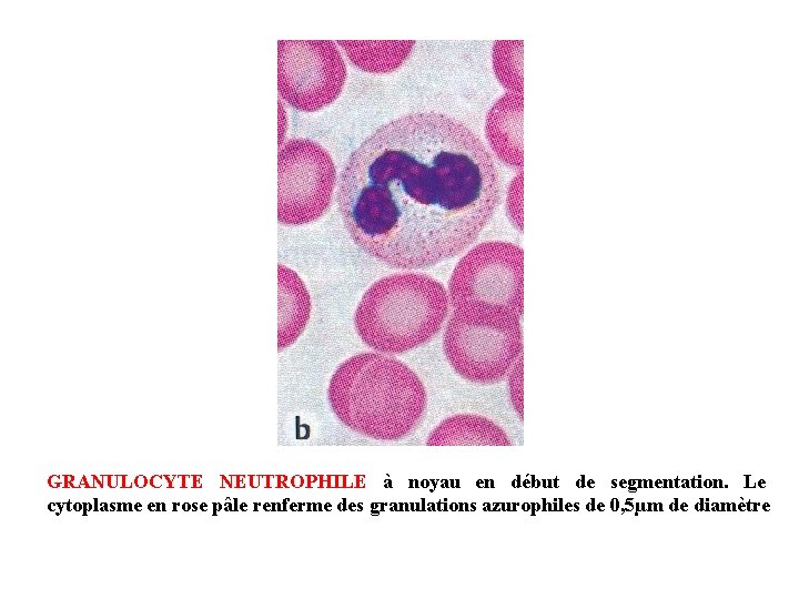 GRANULOCYTE NEUTROPHILE à noyau en début de segmentation. Le cytoplasme en rose pâle renferme