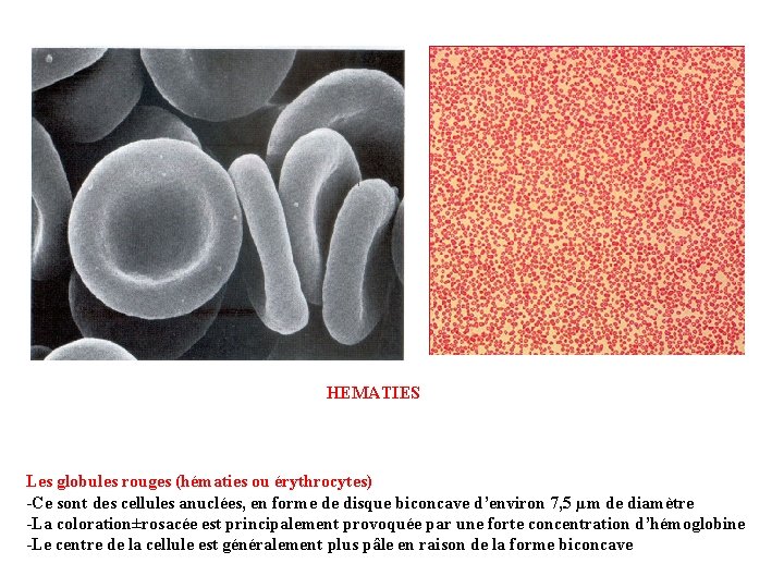 HEMATIES Les globules rouges (hématies ou érythrocytes) -Ce sont des cellules anuclées, en forme