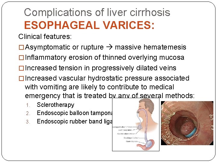 Complications of liver cirrhosis ESOPHAGEAL VARICES: Clinical features: � Asymptomatic or rupture massive hematemesis